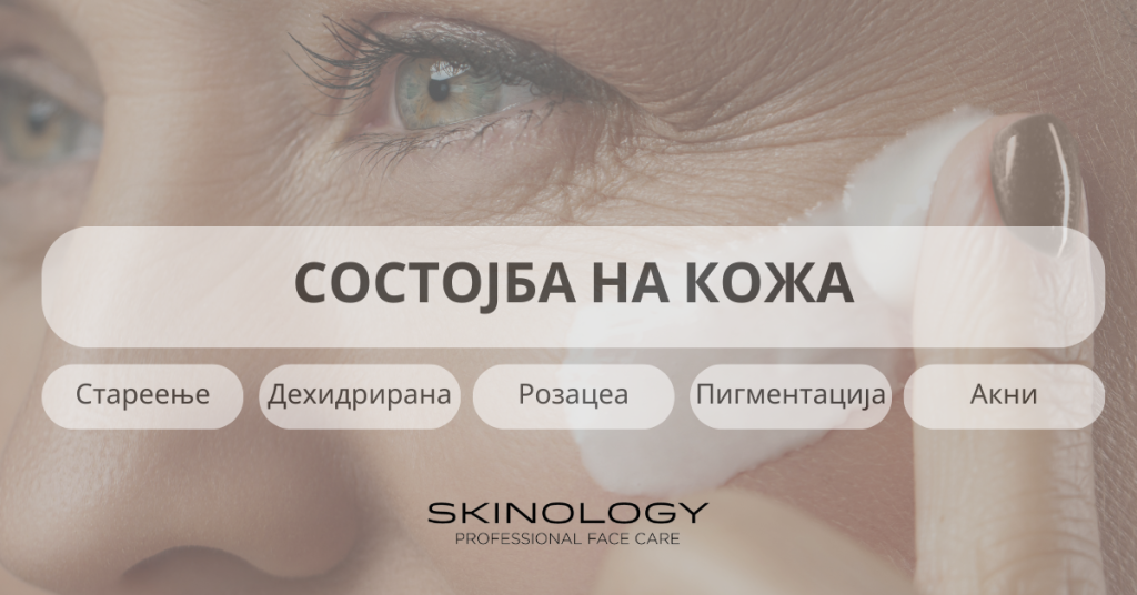 site sostojbi na kozha: stareenje, dehidrirana kozha, rozacea, pigmentacija, akni